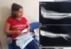 Tarapoto: Adolescente sufre fracturas en ambos brazos tras caer en montículo de construcción dentro de colegio en Picota
