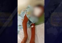 Tarapoto: Menor herido por su padrastro recibe apoyo solidario de Manos Unidas