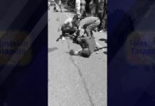 Buenos Aires: Motociclista pierde el pie tras accidente, familiares solicitan apoyo económico y donación de sangre