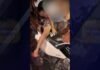 Tarapoto: Niña resultó heridas tras terminar con la pierna dentro de rayos de motocicleta