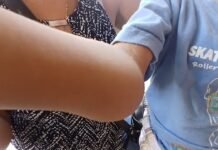 Tarapoto: Manos Unidas entrega apoyo a menor con cáncer que será trasladado a Lima
