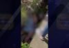 Tarapoto: Joven motociclista de 21 años termina gravemente herido tras despistarse