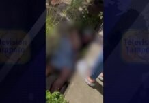 Tarapoto: Joven motociclista de 21 años termina gravemente herido tras despistarse