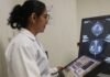 San Martín: Hospital II-2 Tarapoto ofrece mamografías gratuitas para mujeres de 40 a 69 años